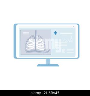 Cartoon piatto x-ray foto di persona costola gabbia, anatomia scheletro umano, materiale didattico concetto di illustrazione vettoriale Illustrazione Vettoriale