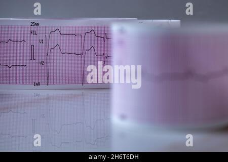 Primo piano di una striscia di carta per grafici con onde cardiache nere che formano un elettrocardiogramma. Concetto di studio o test medico. Foto Stock