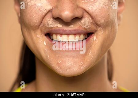 Primo piano di una giovane donna sorridente con il copriciletto sul viso su sfondo beige Foto Stock