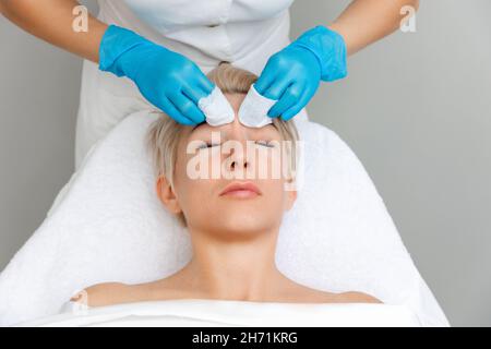 Il cosmetologo professionista effettua una profonda pulizia meccanica del volto del cliente. Vista dall'alto. Concetto di acne. Foto Stock