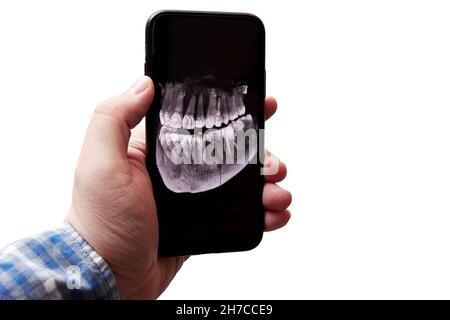 Mano dell'uomo che tiene un telefono cellulare con un'immagine radiografica della sua mascella e del suo dente. Dentista e analisi medica Foto Stock