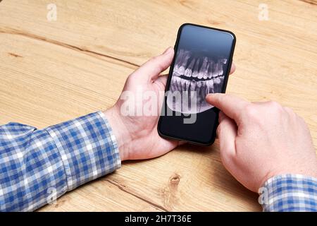 Uomo che analizza un'immagine radiografica dei suoi denti con un impianto a casa. Clinica dentale e trattamento ortodontico Foto Stock