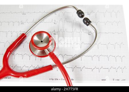 Referto elettrocardiografico (ECG) con battito cardiaco irregolare e stetoscopio rosso sopra di esso Foto Stock