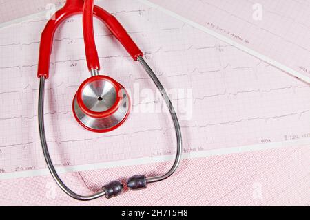 Referto elettrocardiografico (ECG) con battito cardiaco irregolare e stetoscopio rosso sopra di esso Foto Stock