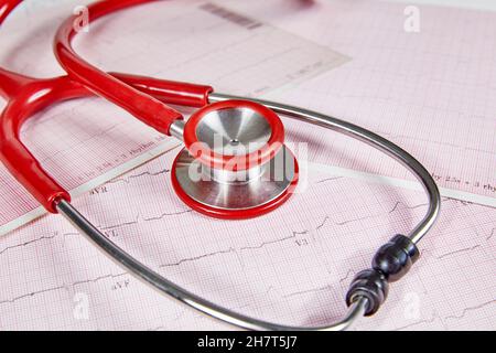 Referto elettrocardiografico (ECG) con battito cardiaco irregolare e stetoscopio rosso sopra di esso Foto Stock