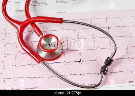 Referto elettrocardiografico (ECG) con battito cardiaco irregolare e stetoscopio rosso sopra di esso Foto Stock