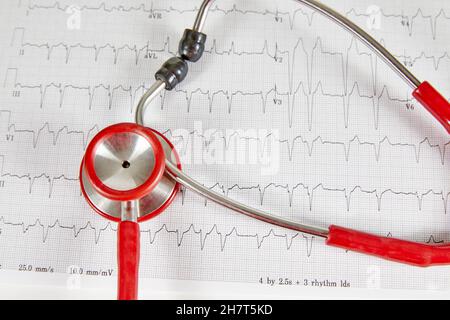 Referto elettrocardiografico (ECG) con battito cardiaco irregolare e stetoscopio rosso sopra di esso Foto Stock