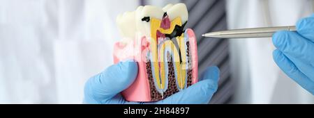 Medico dentista che mostra penna su cavità carious su modello di plastica artificiale del closeup del dente Foto Stock