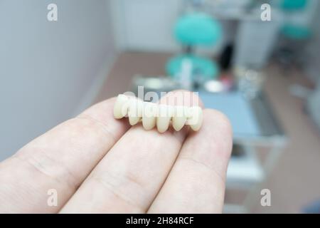 ponti dentali in ceramica metallica nelle mani di un medico Foto Stock