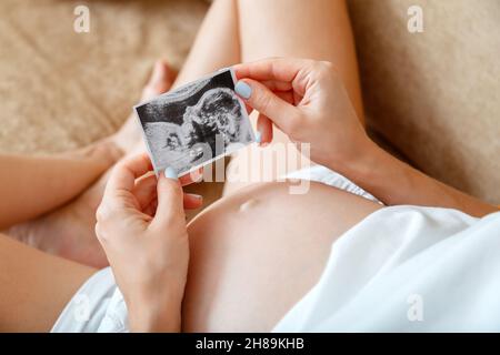 Ultrasuoni bambino foto. Bambino non nato in immagine ecografica in mani femminili di donna incinta. Immagine IVF in prossimità della pancia gravida sul lettino a casa. Mamma è Foto Stock