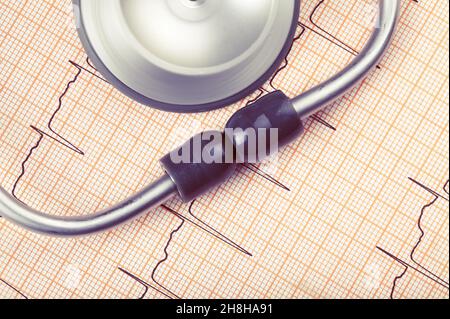 Stetoscopio sulla cartella ECG, concetto medico di diagnostica precoce delle malattie cardiache. Foto Stock