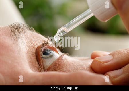 Un uomo inumidisce gli occhi prima di installare le lenti a contatto. Gocce negli occhi da irritazione, arrossamento e allergie. Foto Stock