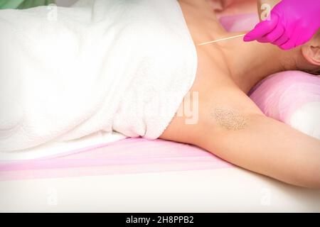 Mano in guanto con spatola depila l'ascella pelosa femminile in una spa Foto Stock