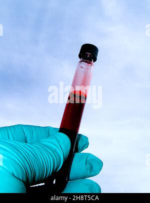 Mano con guanti che ispeziona il sangue nella provetta contro il cielo bianco Foto Stock