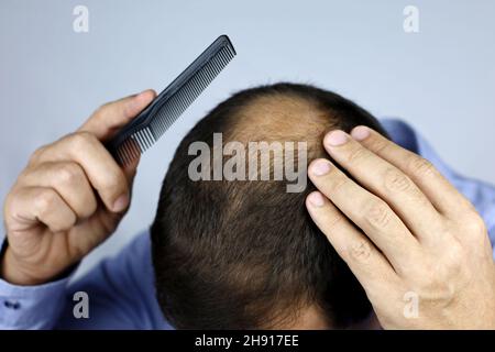 Calvizie, uomo pettando la testa con un pettine. Mano maschio su un calvo, persona preoccupata per la perdita dei capelli Foto Stock