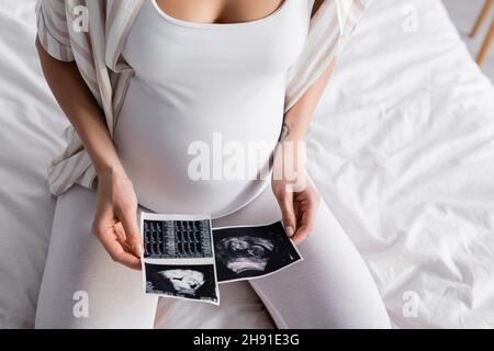 vista parziale di una donna incinta con immagini ecografiche Foto Stock