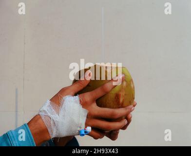 dengue trattamento cibo acqua di cocco in una mano paziente Foto Stock