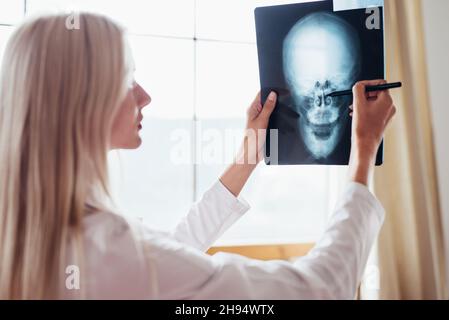 Il medico donna esamina i raggi X del cranio umano. Foto Stock