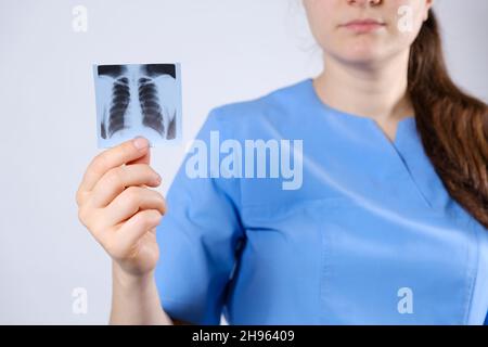 Un medico in una uniforme blu mostra un'immagine di un fluorogramma di fluorografia, una radiografia dei polmoni per la prevenzione e la diagnosi precoce di Foto Stock