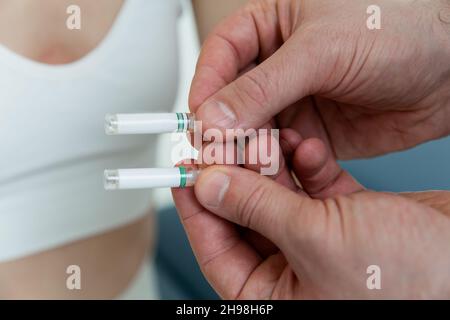 Il medico tiene in mano piccole fiale. Primo piano della fiala piccola con un vaccino in mano al medico. Provetta per test allergico. Test di allergia Foto Stock