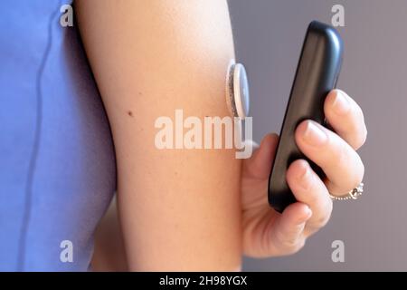 Mano femminile con monitor glicemico continuo che mostra il livello di glucosio Foto Stock