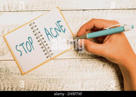 Scrittura visualizzazione testo Stop Acne. Panoramica aziendale controllare l'insorgenza di ghiandole sebacee infiammate nella pelle problemi di brainstorming e. Foto Stock