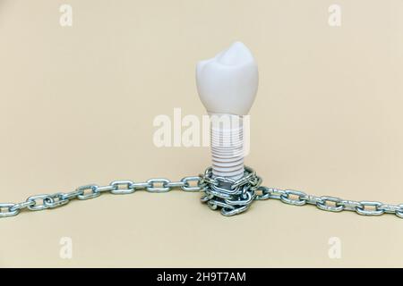 L'impianto dentale è attorcigliato con una catena metallica su uno sfondo beige. Modello di impianto dentale del dente artificiale. Concetto di odontoiatria e strumento medico Foto Stock