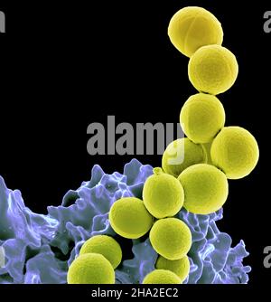 MRSA (giallo) o Staphylococcus Aureus resistente alla meticillina ingerito da neutrofili (blu violaceo). Foto Stock