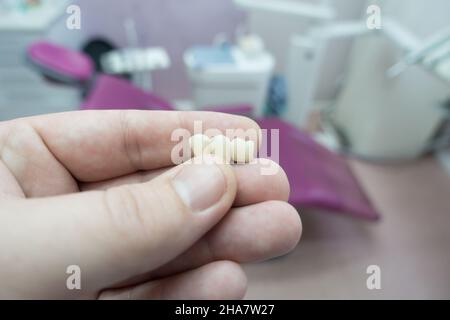 ponti dentali in ceramica metallica nelle mani di un medico Foto Stock