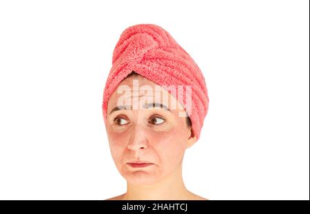 Volto triste di giovane donna con irritazione della pelle, arrossamento, problemi della pelle, acne, eruzione cutanea o scottature isolate su sfondo bianco Foto Stock