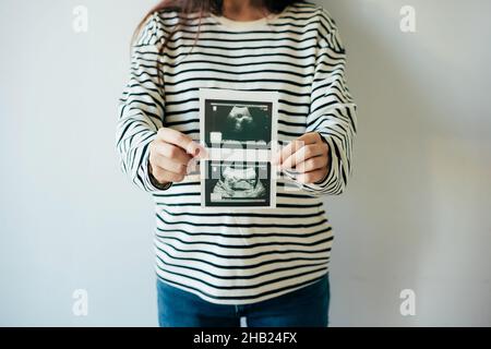 Una donna in previsione della nascita di un bambino tiene una scansione ecografica davanti a lei. Foto Stock