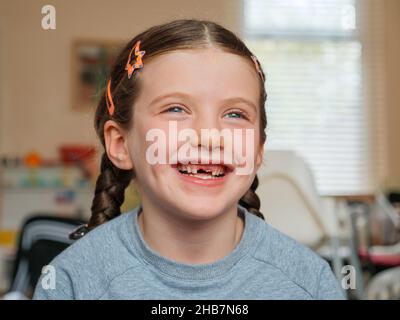 Ritratto di felice sorridente ragazza di sette anni che ha perso i denti anteriori del bambino che sono caduti fuori Foto Stock
