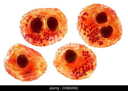 Citomegalovirus umani (HCMV) in una cellula che produce 'occhio del gufo' corpi di inclusione, illustrazione del calcolatore. Le cellule sono multinucleate con vacuolizzazione perinucleare. HCMV è un membro della famiglia degli herpesvirus. Ha un elevato tasso di infezione ed è una delle principali cause di malattia nei neonati vulnerabili e nei pazienti immunocompromessi, ma in genere non causa la malattia negli adulti sani. Foto Stock