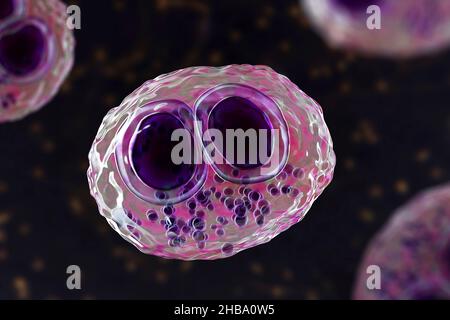 Citomegalovirus umani (HCMV) in una cellula che produce 'occhio del gufo' corpi di inclusione, illustrazione del calcolatore. Le cellule sono multinucleate con vacuolizzazione perinucleare. HCMV è un membro della famiglia degli herpesvirus. Ha un elevato tasso di infezione ed è una delle principali cause di malattia nei neonati vulnerabili e nei pazienti immunocompromessi, ma in genere non causa la malattia negli adulti sani. Foto Stock