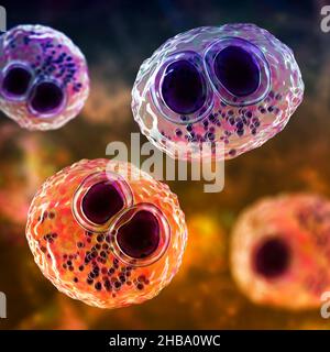 Citomegalovirus umani (HCMV) in una cellula che produce 'occhio del gufo' corpi di inclusione, illustrazione del calcolatore. Le cellule sono multinucleate con vacuolizzazione perinucleare. HCMV è un membro della famiglia degli herpesvirus. Ha un elevato tasso di infezione ed è una delle principali cause di malattia nei neonati vulnerabili e nei pazienti immunocompromessi, ma in genere non causa la malattia negli adulti sani. Foto Stock