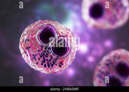 Citomegalovirus umani (HCMV) in una cellula che produce 'occhio del gufo' corpi di inclusione, illustrazione del calcolatore. Le cellule sono multinucleate con vacuolizzazione perinucleare. HCMV è un membro della famiglia degli herpesvirus. Ha un elevato tasso di infezione ed è una delle principali cause di malattia nei neonati vulnerabili e nei pazienti immunocompromessi, ma in genere non causa la malattia negli adulti sani. Foto Stock