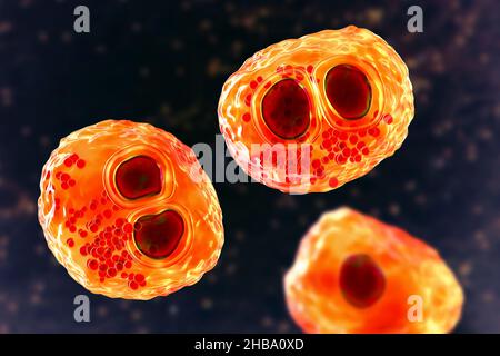 Citomegalovirus umani (HCMV) in una cellula che produce 'occhio del gufo' corpi di inclusione, illustrazione del calcolatore. Le cellule sono multinucleate con vacuolizzazione perinucleare. HCMV è un membro della famiglia degli herpesvirus. Ha un elevato tasso di infezione ed è una delle principali cause di malattia nei neonati vulnerabili e nei pazienti immunocompromessi, ma in genere non causa la malattia negli adulti sani. Foto Stock