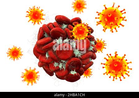 Coagulazione del sangue e particelle di virus COVID-19, illustrazione concettuale. Malattia di Covid-19 e complicazioni vaccinali, trombosi, tromboembolia. Foto Stock