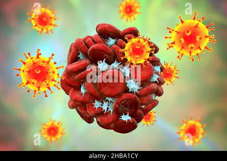 Coagulazione del sangue e particelle di virus COVID-19, illustrazione concettuale. Malattia di Covid-19 e complicazioni vaccinali, trombosi, tromboembolia. Foto Stock