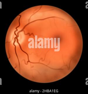 Illustrazione della retina oculare sana che mostra disco ottico, vasi sanguigni, macula, e fovea. Foto Stock