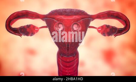 Gravidanza multipla, illustrazione. Gemelli dizigoti che si sviluppano nell'utero separatamente alla settimana 8. Foto Stock