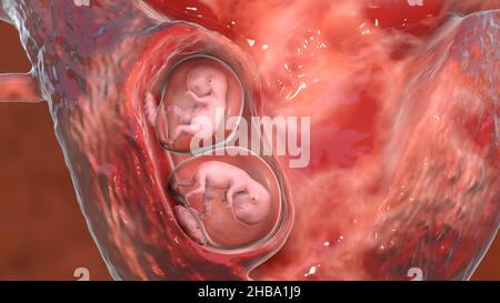 Gravidanza multipla, illustrazione. Gemelli monozigoti in utero che condividono la stessa placenta alla settimana 8. Foto Stock