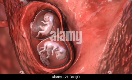 Gravidanza multipla, illustrazione. Gemelli monozigoti in utero che condividono la stessa placenta alla settimana 8. Foto Stock