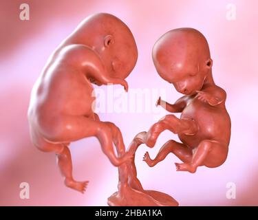 Gravidanza multipla, illustrazione. Gemelli monozigoti nell'utero che condividono la stessa placenta. Questo è il periodo fetale iniziale tra la settimana 8 e la settimana 16. Foto Stock
