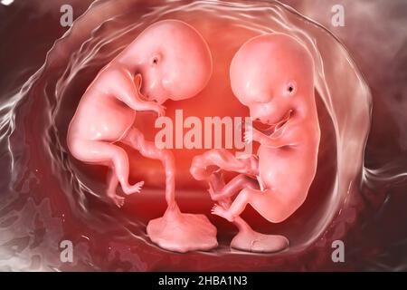 Gravidanza multipla, illustrazione. Gemelli monozigoti nell'utero con placentas separate. Questo è il periodo fetale iniziale tra la settimana 8 e la settimana 16. Foto Stock