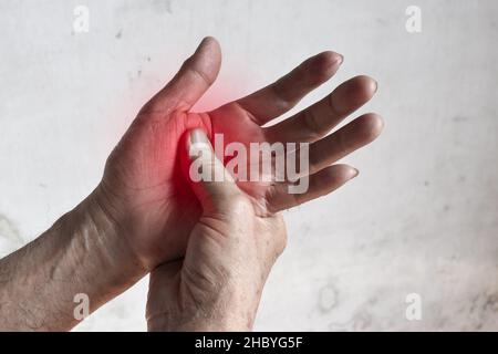 Aspetto palmo doloroso del vecchio asiatico. Concetto di sindrome compartimentale, cellulite e dolore ai muscoli delle mani. Foto Stock