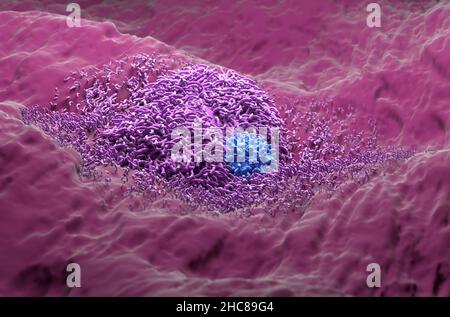 Epatoma del cancro del fegato con colseup realistico a cellule T vista 3D illustrazione Foto Stock