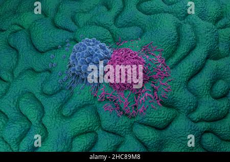 Visualizzazione isometrica delle cellule del cancro gastrico dello stomaco 3D illustrazione Foto Stock