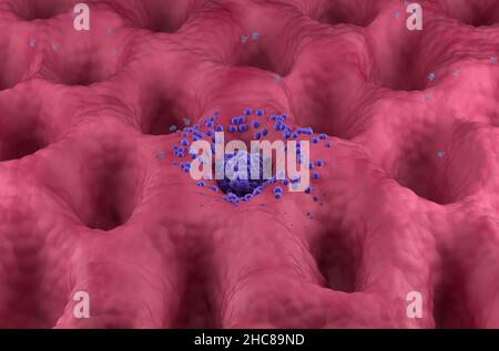 Tumore del cancro gastrico in fase iniziale sulla parete dello stomaco vista frontale 3D illustrazione Foto Stock