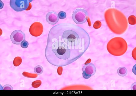 Figura di rappresentazione della cellula Reed-Sternberg in hodgkin linfoma isometrico 3D Foto Stock